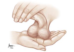 Use both hands to examine each testicle.